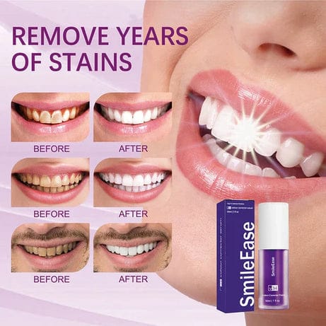 Teeth Brightening Hismile For Teeth Brightening