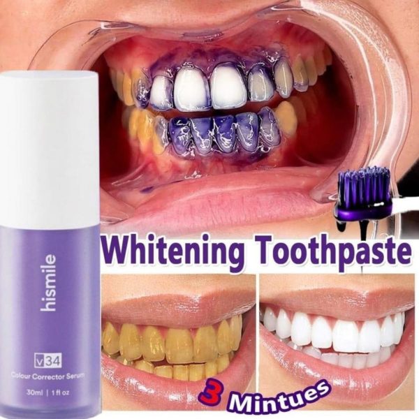 Teeth Brightening Hismile For Teeth Brightening
